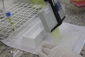 Profissionais de saúde de Minas estão reunidos para aprimoramento da técnica de diagnóstico da tuberculose