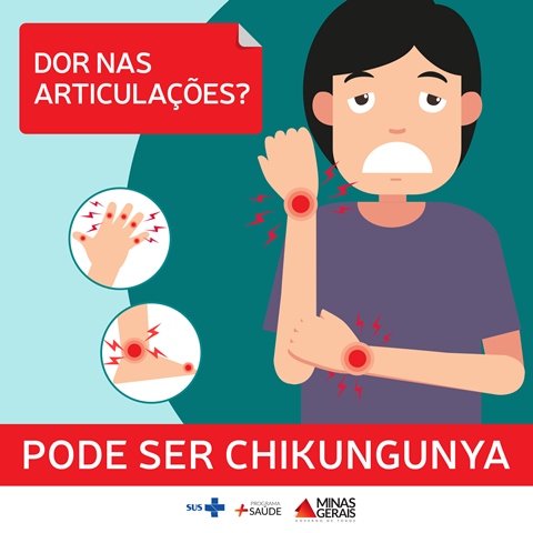 post dores