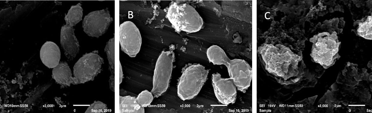 Candidiase
