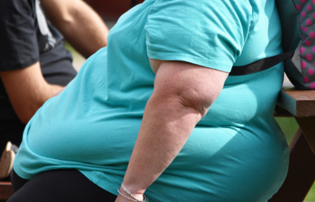 Obesidade é doença crônica que mais cresce no mundo - Imagem: Reprodução